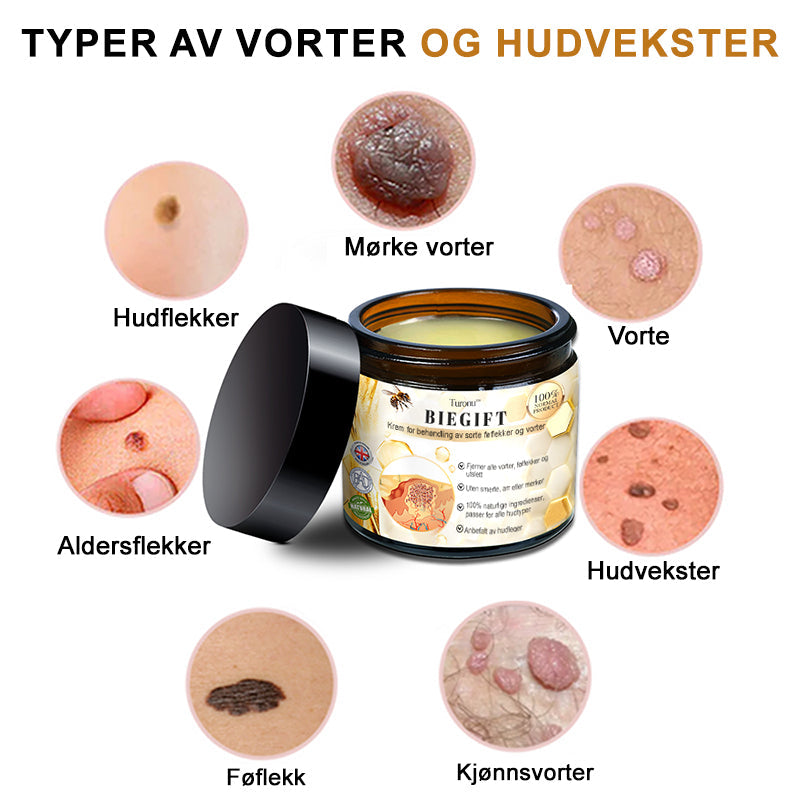 👔Turoment™ Bie Gift Behandlingskrem (🔥Siste dag, 80 % rabatt)