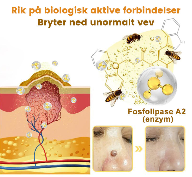 🐆Turoment™ Bie Gift Behandlingskrem (🔥Siste dag, 80 % rabatt)