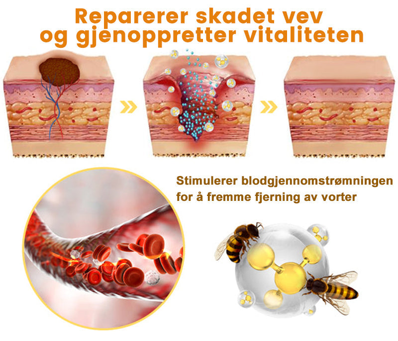 👔Turoment™ Bie Gift Behandlingskrem (🔥Siste dag, 80 % rabatt)