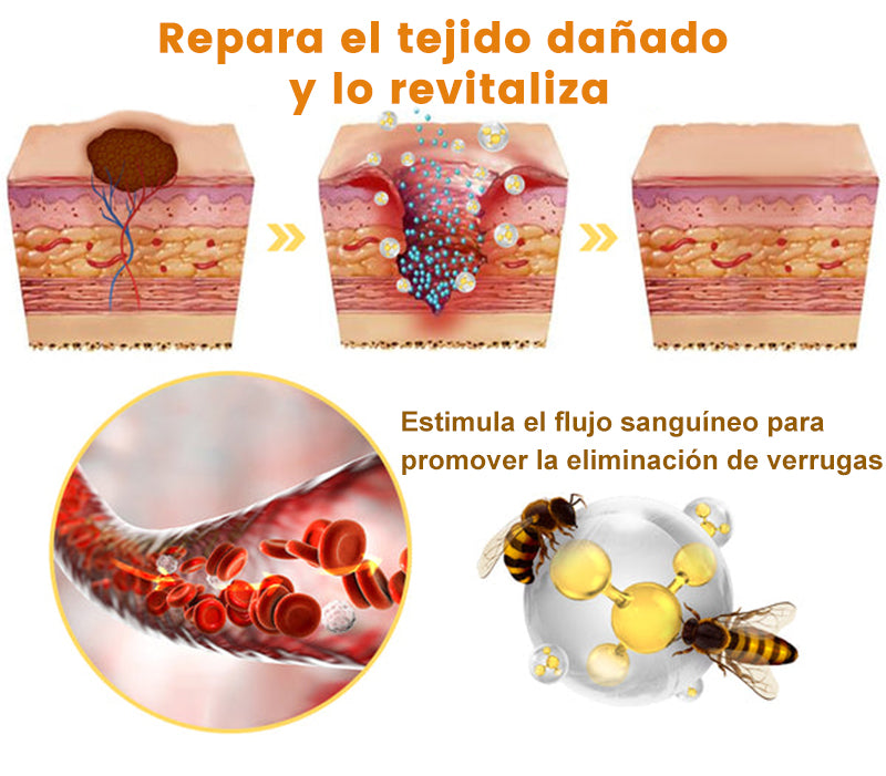 🎏Turonu™ Crema de Tratamiento con Veneno de Abeja (🔥Último día, 80 % de descuento)