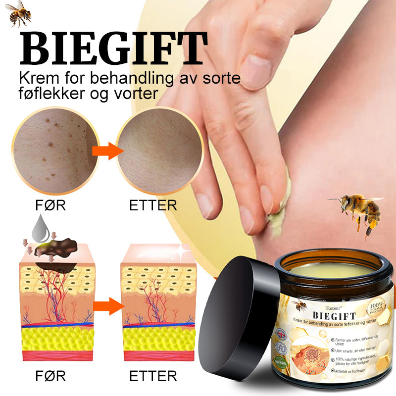 👔Turoment™ Bie Gift Behandlingskrem (🔥Siste dag, 80 % rabatt)