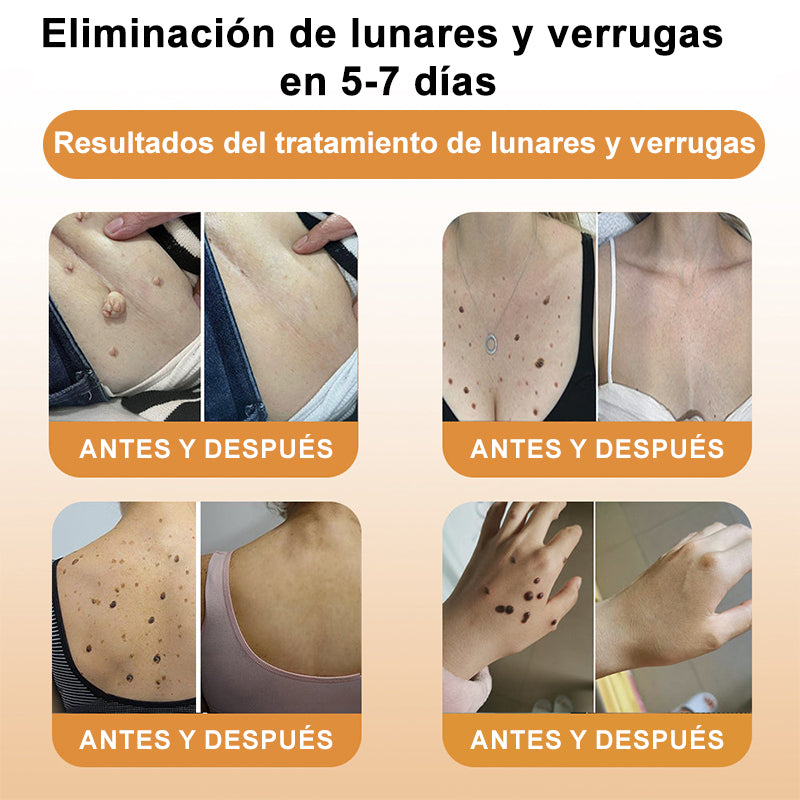 🎏Turonu™ Crema de Tratamiento con Veneno de Abeja (🔥Último día, 80 % de descuento)