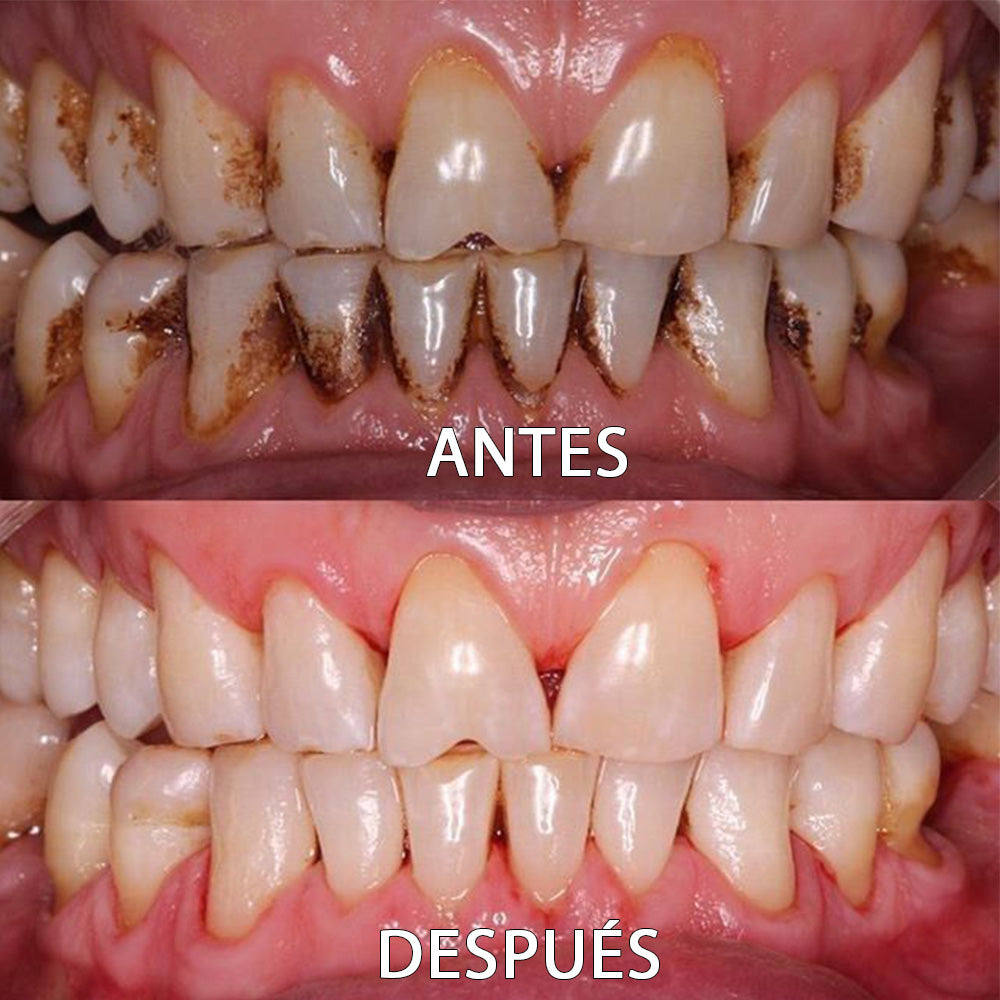 ✅👨🏻⚕️Tienda Oficial | Ourlyard™ Polvo Mineral para la Salud Denta👨🏻⚕️Obtener la Certificación de la Agencia Española de Medicamentos y Productos Sanitarios (AEMPS)
