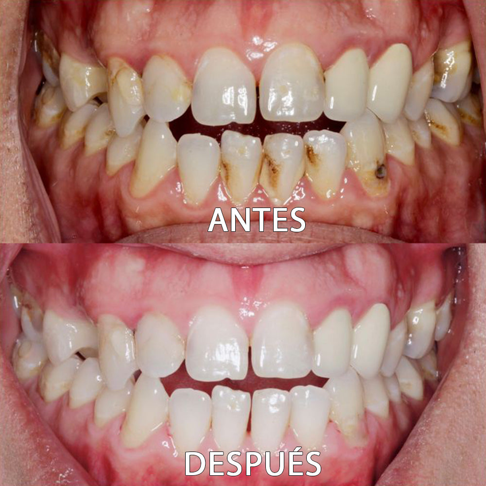 ✅👨🏻⚕️Tienda Oficial | Ourlyard™ Polvo Mineral para la Salud Denta👨🏻⚕️Obtener la Certificación de la Agencia Española de Medicamentos y Productos Sanitarios (AEMPS)