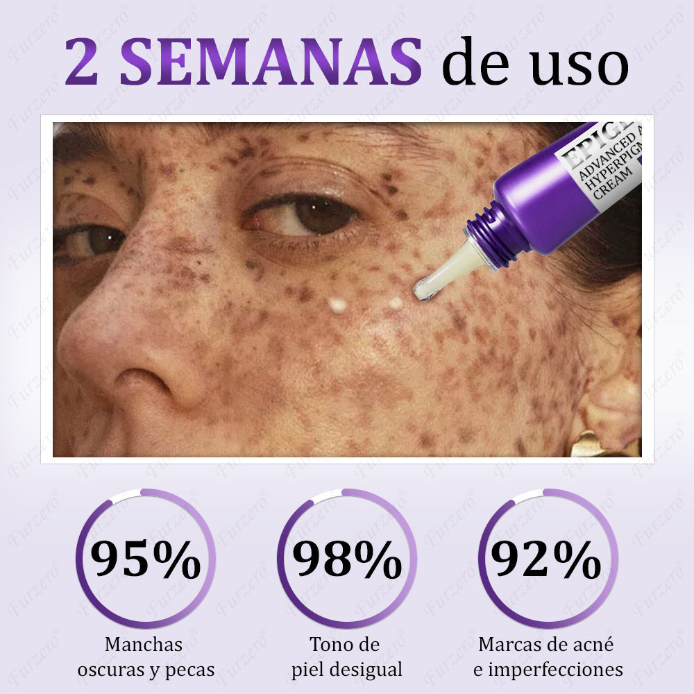 🔥Aprobado por el AEMPS | Furzero® EPIGLOW MelanEX Crema Avanzada Anti-Hiperpigmentación