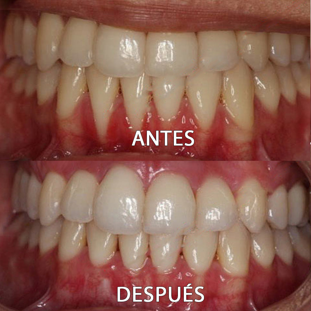✅👨🏻⚕️Tienda Oficial | Ourlyard™ Polvo Mineral para la Salud Denta👨🏻⚕️Obtener la Certificación de la Agencia Española de Medicamentos y Productos Sanitarios (AEMPS)