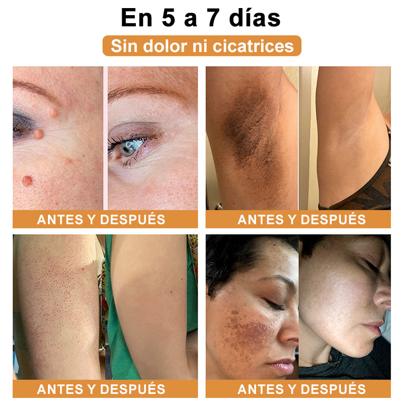 🎏Turonu™ Crema de Tratamiento con Veneno de Abeja (🔥Último día, 80 % de descuento)