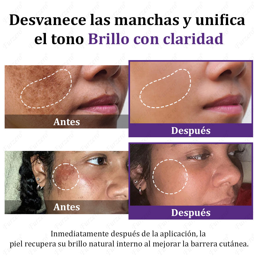 🔥Aprobado por el AEMPS | Furzero® EPIGLOW MelanEX Crema Avanzada Anti-Hiperpigmentación