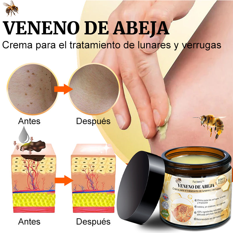 🎏Turonu™ Crema de Tratamiento con Veneno de Abeja (🔥Último día, 80 % de descuento)