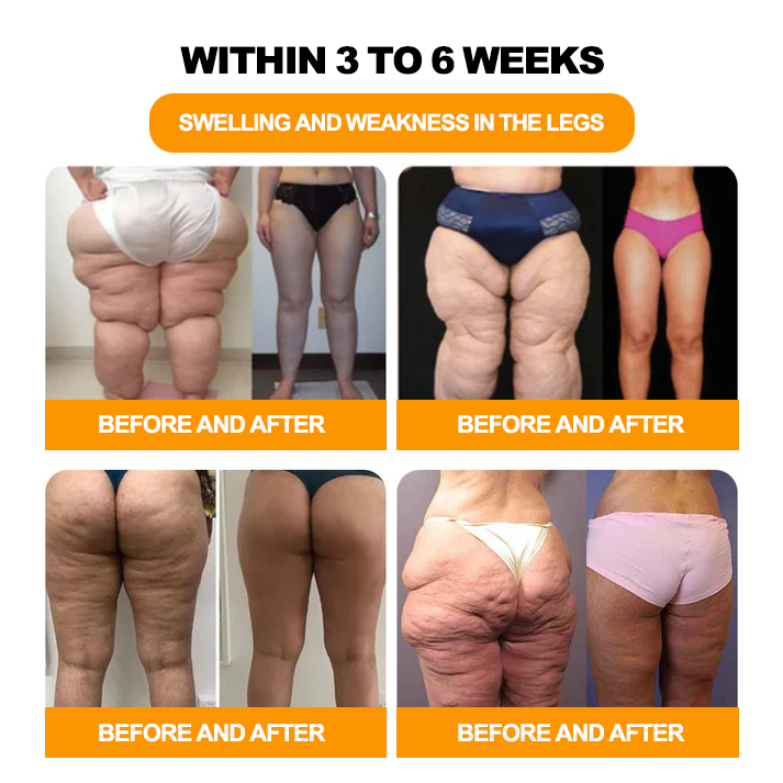 GFOUK™ 30-Hierbas Para Adelgazamiento y Desintoxicación - Perlas para Baño de Pies - 💓👩⚕️