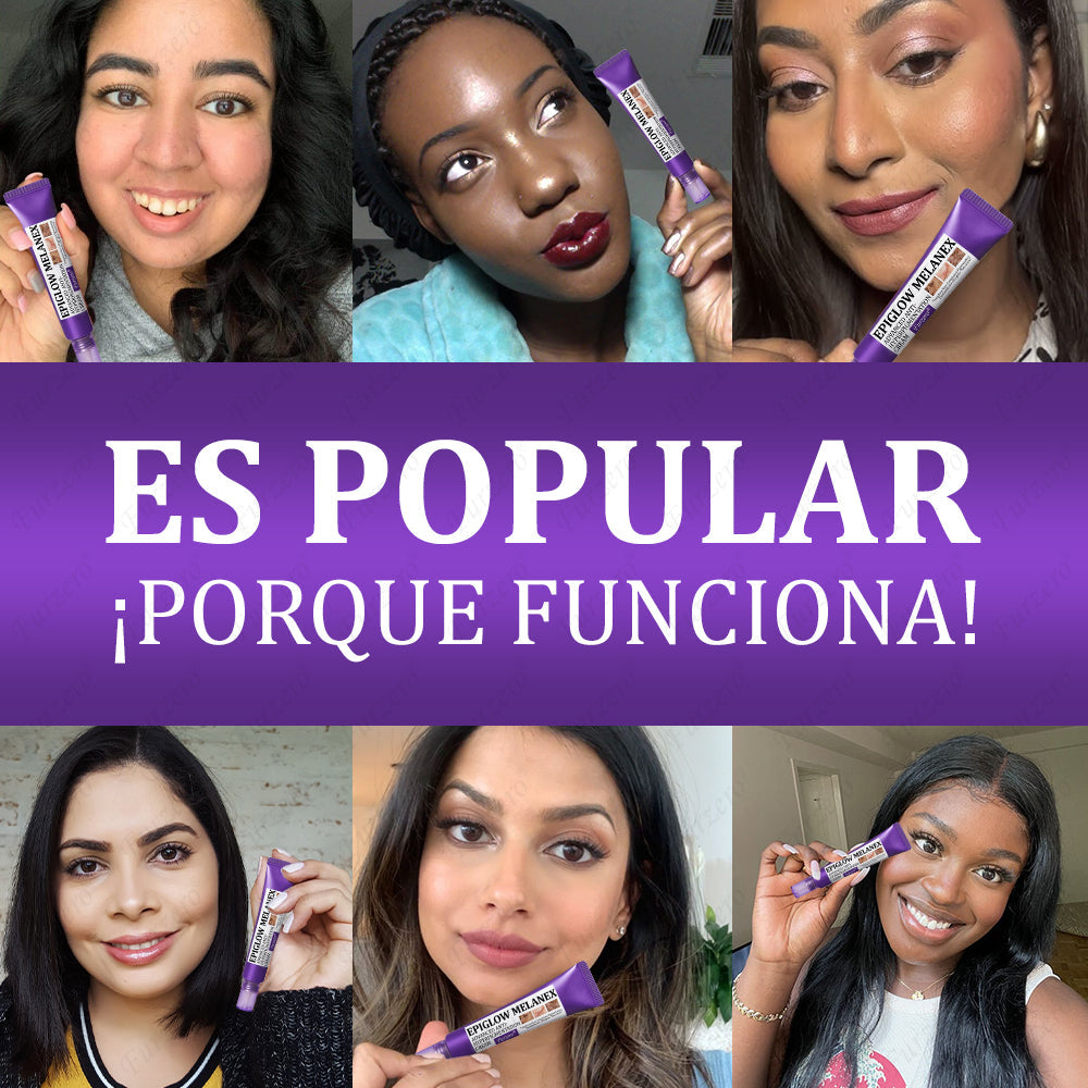 🔥Aprobado por el AEMPS | Furzero® EPIGLOW MelanEX Crema Avanzada Anti-Hiperpigmentación