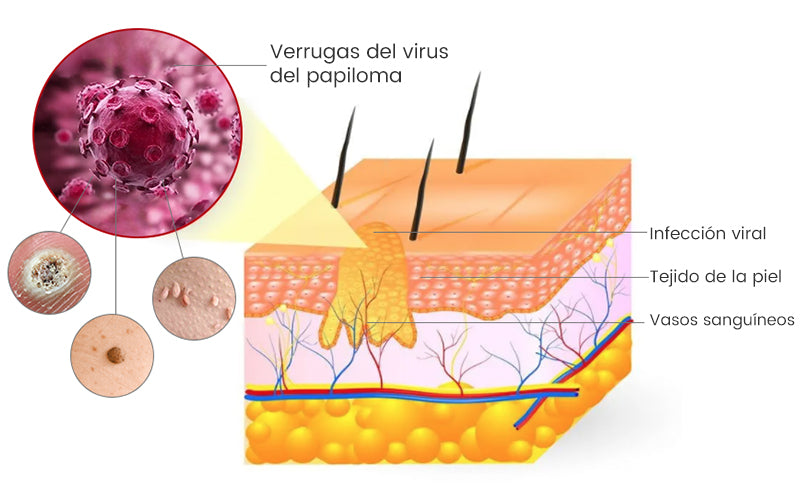🎏Turonu™ Crema de Tratamiento con Veneno de Abeja (🔥Último día, 80 % de descuento)