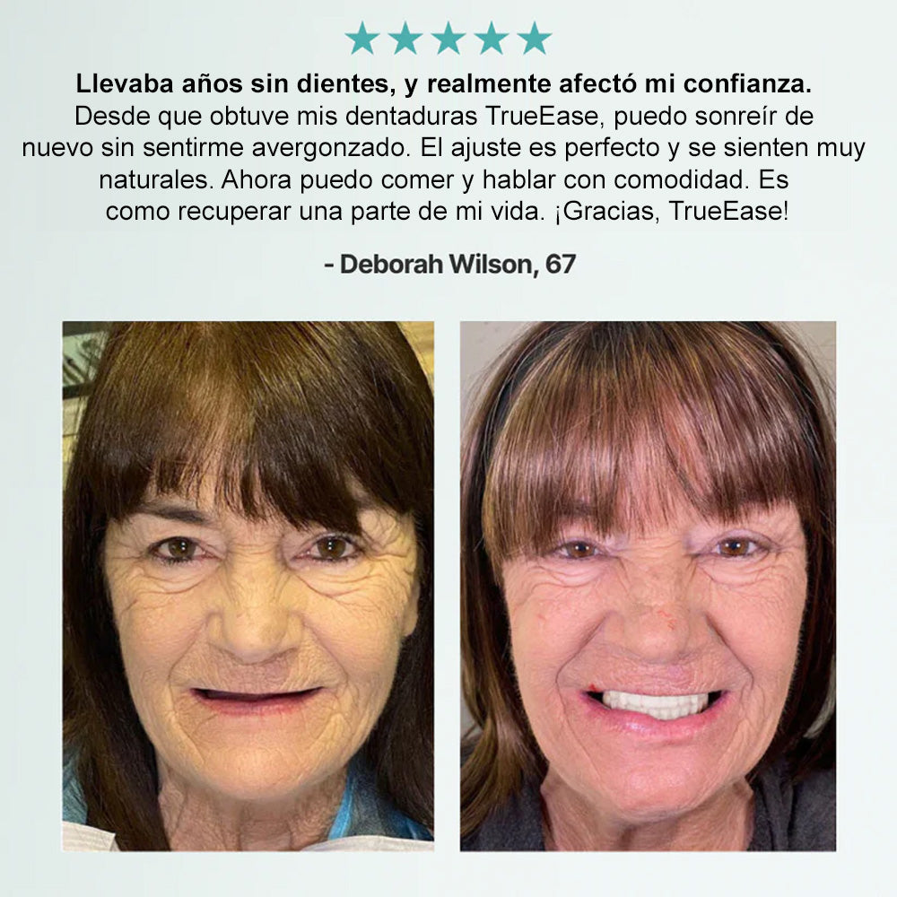 🦷 Bikenda® 🦷Conjunto Completo de Dentaduras Personalizadas Avanzadas (✅ Dentaduras de ajuste cómodo respaldadas clínicamente — España )