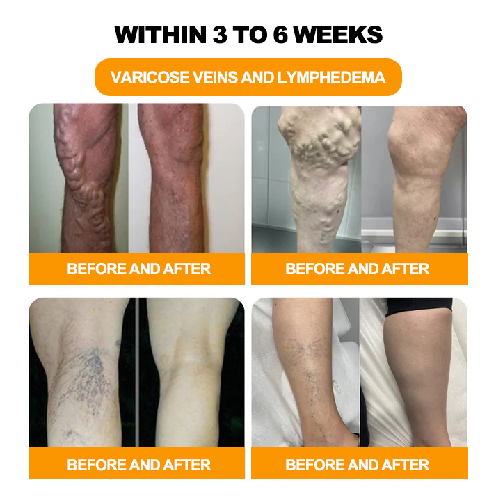 GFOUK™ 30-Hierbas Para Adelgazamiento y Desintoxicación - Perlas para Baño de Pies - 💓👩⚕️