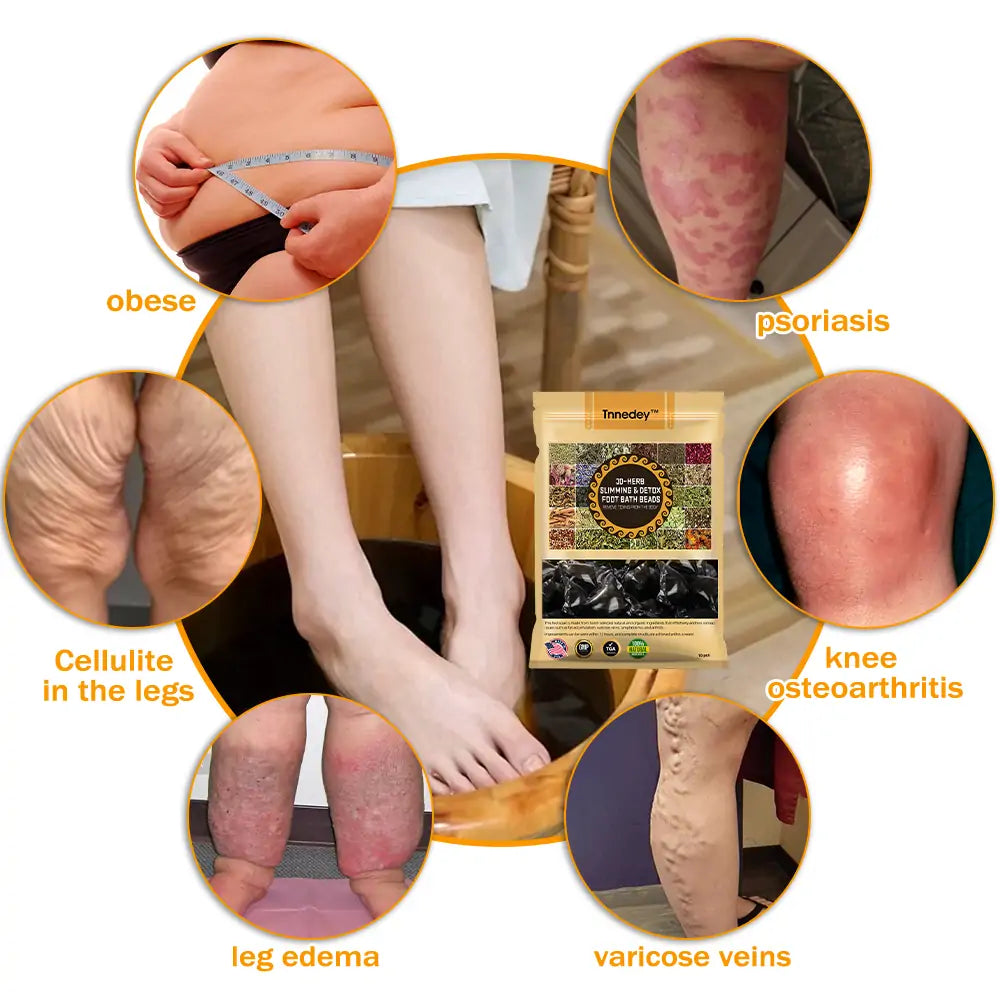 GFOUK™ 30-Hierbas Para Adelgazamiento y Desintoxicación - Perlas para Baño de Pies - 💓👩⚕️