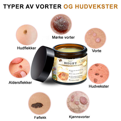 👔Turoment™ Bie Gift Behandlingskrem (🔥Siste dag, 80 % rabatt)