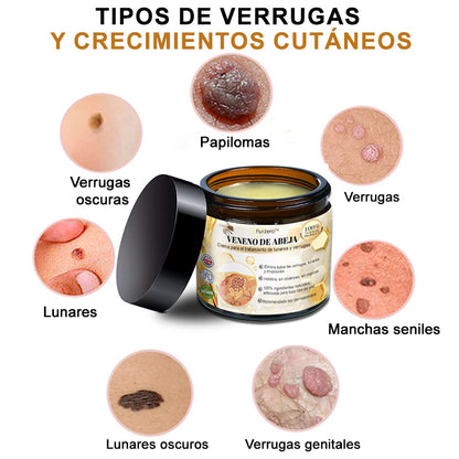 🎏Turonu™ Crema de Tratamiento con Veneno de Abeja (🔥Último día, 80 % de descuento)