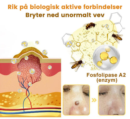 🐆Turoment™ Bie Gift Behandlingskrem (🔥Siste dag, 80 % rabatt)