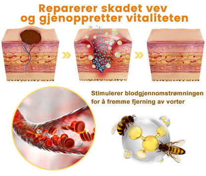 👔Turoment™ Bie Gift Behandlingskrem (🔥Siste dag, 80 % rabatt)