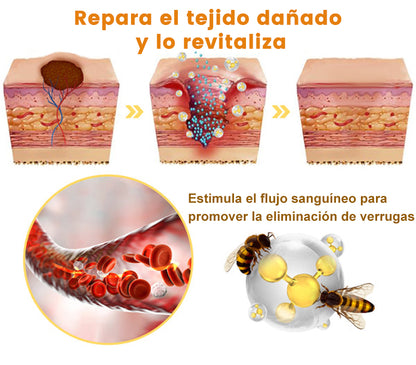 🎏Turonu™ Crema de Tratamiento con Veneno de Abeja (🔥Último día, 80 % de descuento)
