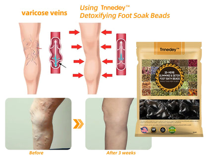 GFOUK™ 30-Hierbas Para Adelgazamiento y Desintoxicación - Perlas para Baño de Pies - 💓👩‍⚕️