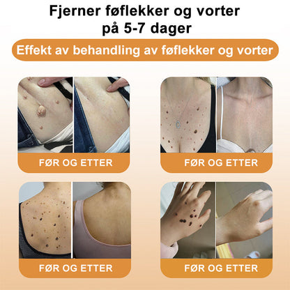 👔Turoment™ Bie Gift Behandlingskrem (🔥Siste dag, 80 % rabatt)