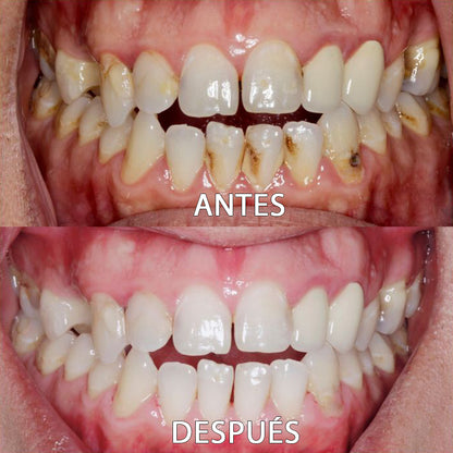 ✅👨🏻‍⚕️Tienda Oficial | Ourlyard™ Polvo Mineral para la Salud Denta👨🏻‍⚕️Obtener la Certificación de la Agencia Española de Medicamentos y Productos Sanitarios (AEMPS)