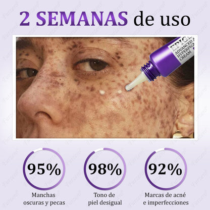 🔥Aprobado por el AEMPS | Furzero® EPIGLOW MelanEX Crema Avanzada Anti-Hiperpigmentación