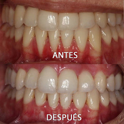 ✅👨🏻‍⚕️Tienda Oficial | Ourlyard™ Polvo Mineral para la Salud Denta👨🏻‍⚕️Obtener la Certificación de la Agencia Española de Medicamentos y Productos Sanitarios (AEMPS)
