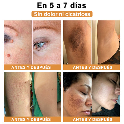 🎏Turonu™ Crema de Tratamiento con Veneno de Abeja (🔥Último día, 80 % de descuento)