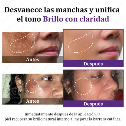 🔥Aprobado por el AEMPS | Furzero® EPIGLOW MelanEX Crema Avanzada Anti-Hiperpigmentación