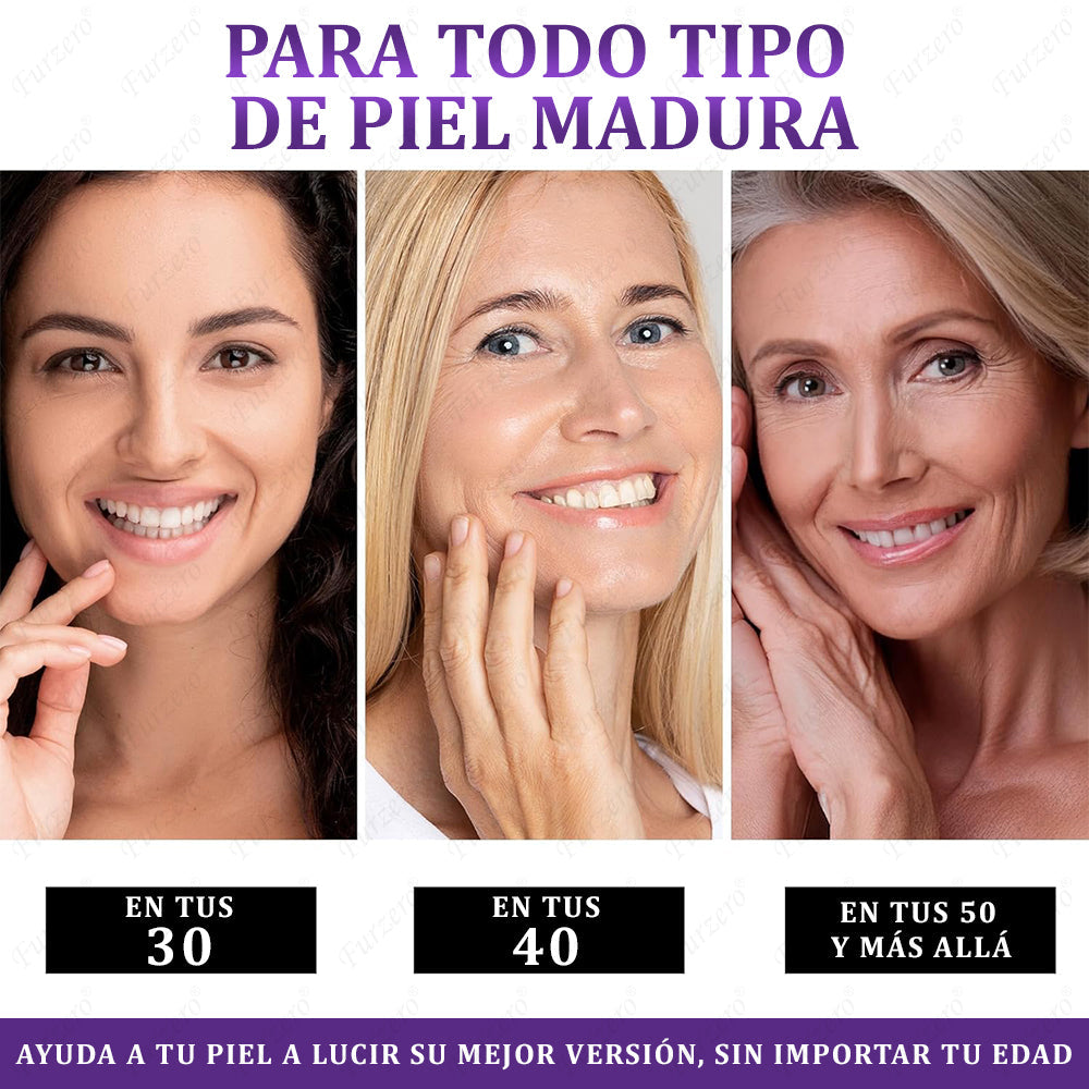 🔥Aprobado por el AEMPS | Furzero® EPIGLOW MelanEX Crema Avanzada Anti-Hiperpigmentación